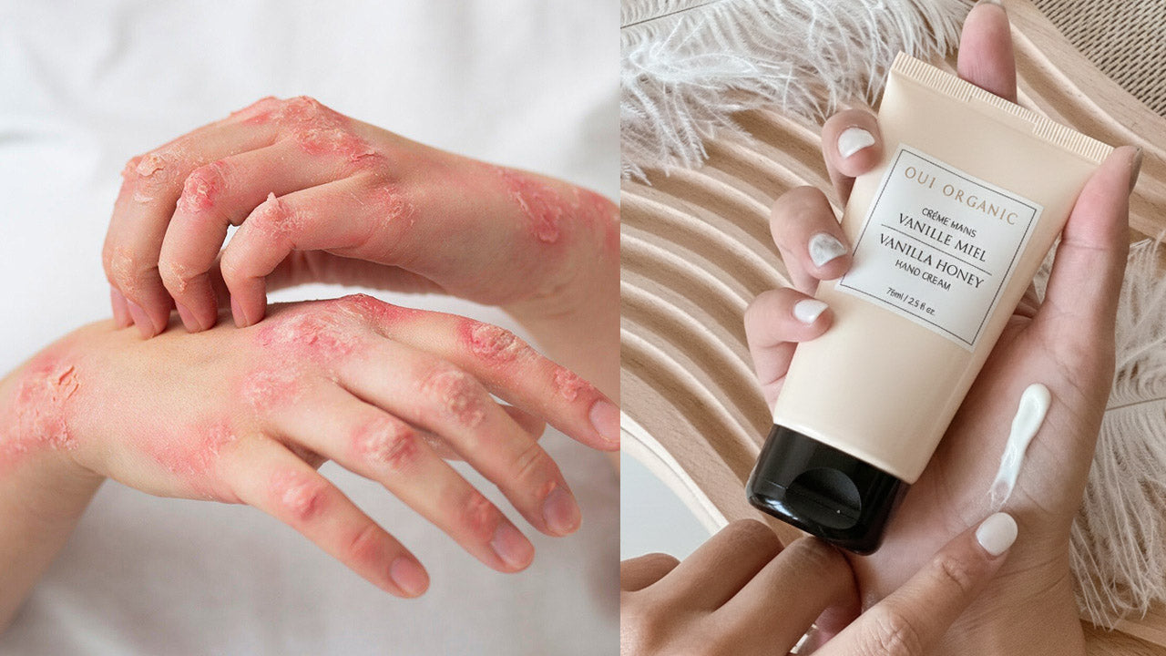 乾裂手、富貴手怎麼辦?秋冬必學 6 大護手技巧,輕鬆維持柔嫩雙手