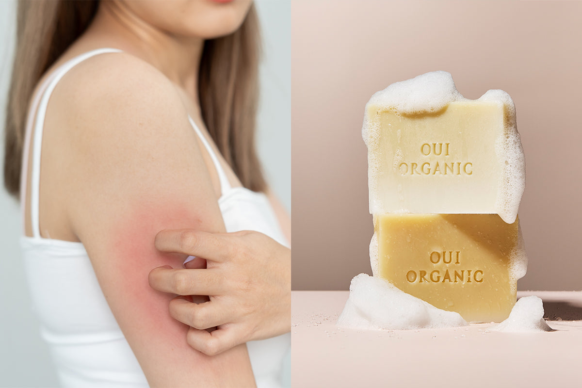天然植萃手工皂真的是敏感肌救星？皮膚科觀點這樣說！